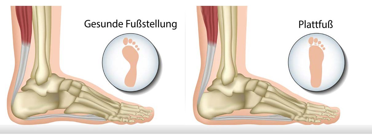 Einlagen